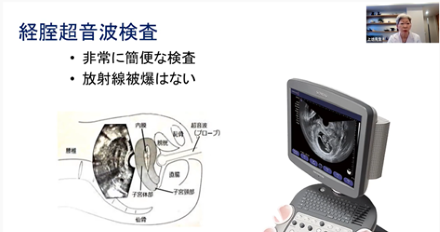 経腟超音波検査でわかる子宮・卵巣の病気